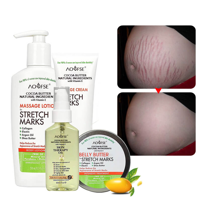 remove pregnancy scars cream