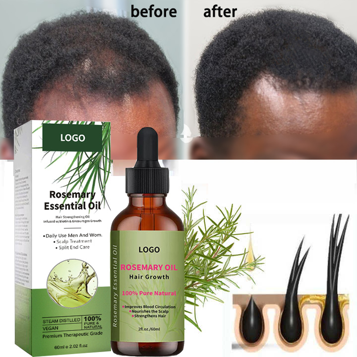 Is Rosemary essential oil used to grow hair and reduce hair loss? The effect is better than.....
