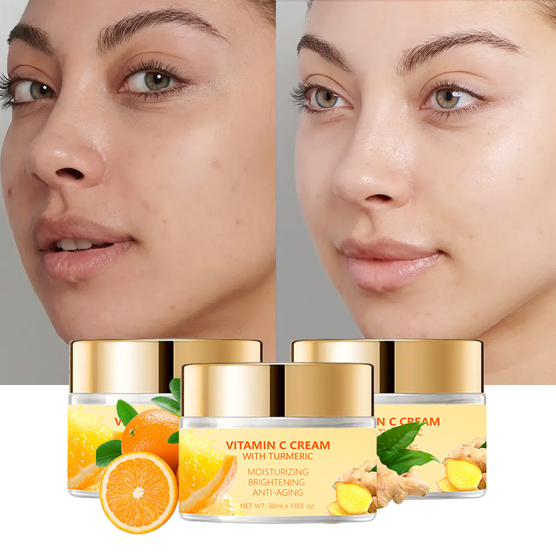 Bid farewell to dark spots with vitamin c face cream for a youthful glow